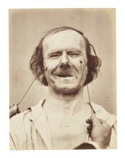 Guillaume-Benjamin Duchenne De Boulogne - Personage Masculin, From Mecanisme De La Physionomie Humaine, C. 1865