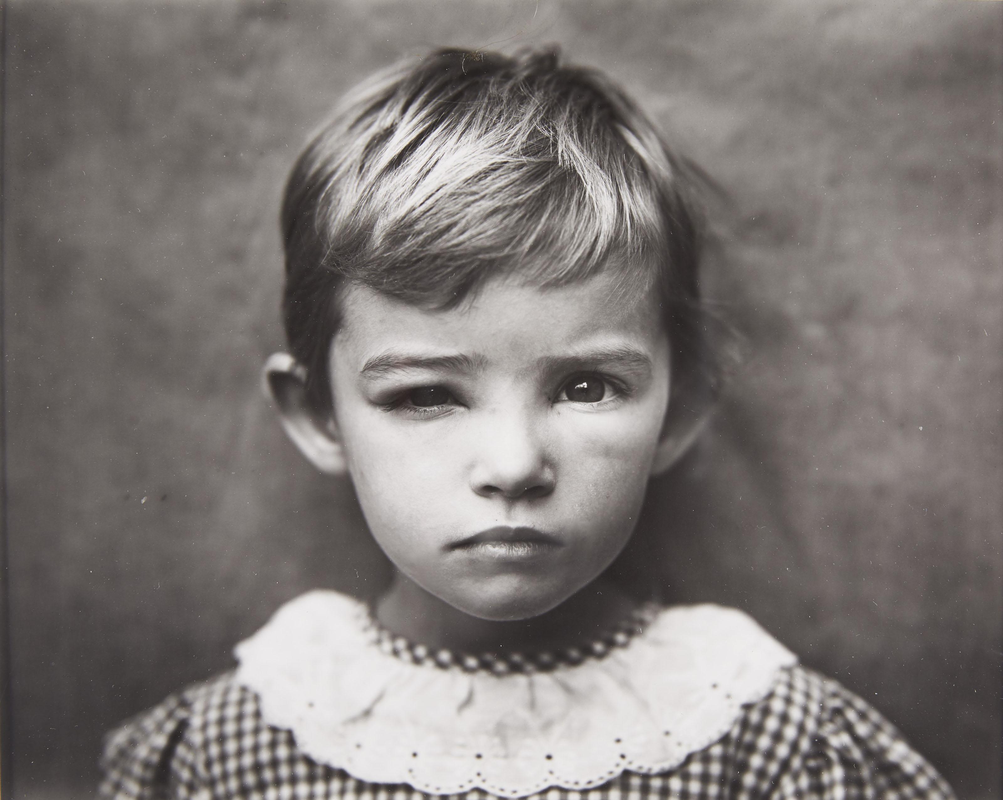 Damaged Child, 1984 by Sally Mann | Art.Salon